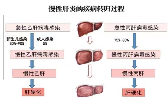 【健康科普】世界肝炎日——堅(jiān)持早預(yù)防，加強(qiáng)檢測(cè)發(fā)現(xiàn)，規(guī)范抗病毒治療